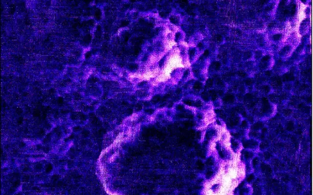 Rasterkraftmikroskopieaufnahme in Violetttönen zeigt die Oberflächenmorphologie eines Virus mit mehreren runden Strukturen.