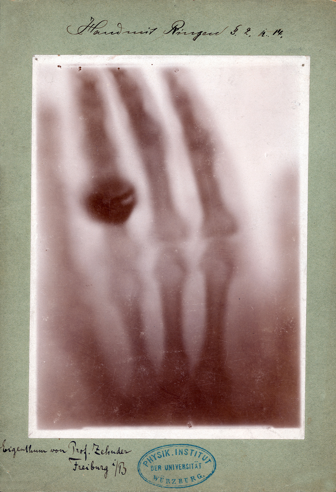 Im ersten Röntgenbild der Menscheihtsgeschichte sind die Glieder der Handknochen deutlich zu erkennen.